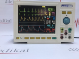 PETAŞ HASTA BAŞI MONİTÖRÜ ETCO2